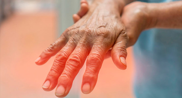 Antioksidan dari buah-buahan